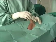 Sperm sample taken by Two nurse surgical