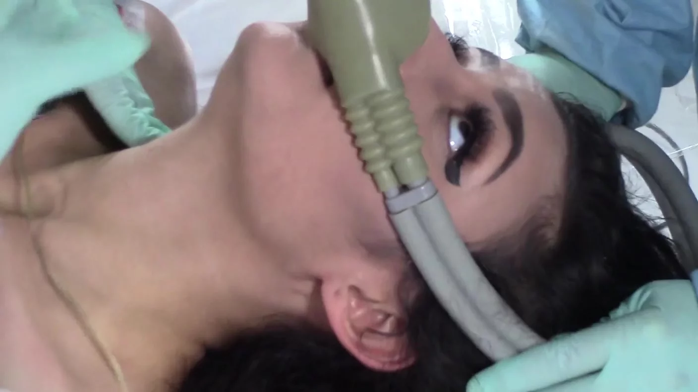 BoundHub - forcing the anesthesia gass