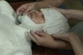 BoundHub - Plaster Encasement Mummification